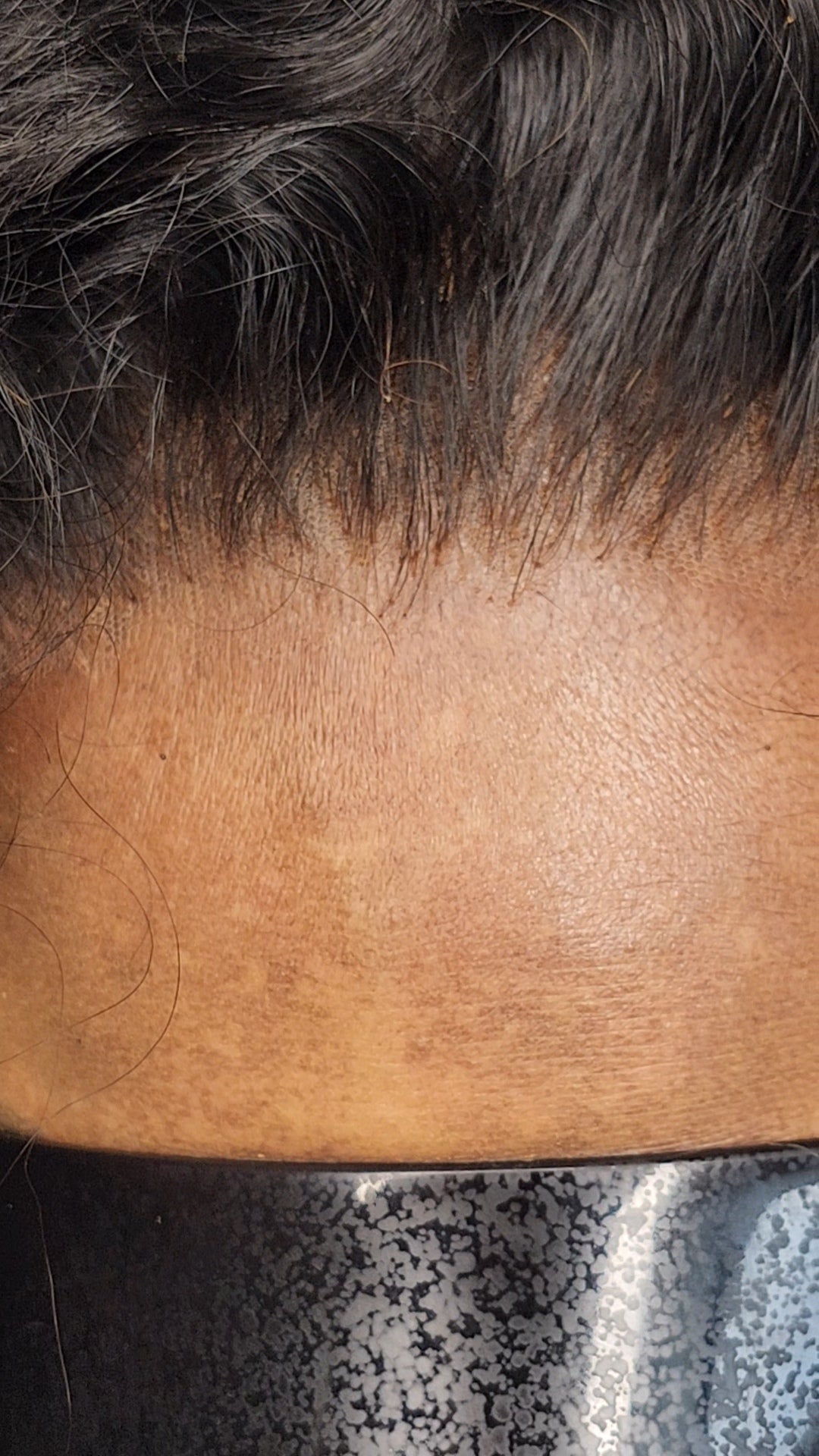 CUSTOMIZED HD CLOSURES + Bundle Deals